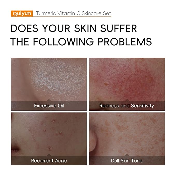 Skin Care Set, Turmeric Vitamin C Beauty Gift Sets, Skincare Kit with Serum, Eye Cream, Cream, 2 Type Mud Mask, Soap, Facial Oil Travel Kit for Women Teens Girls, Improve Dark Spot, Reduce Acne