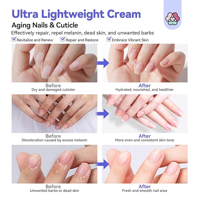 SAVILAND 2024 Ultra-Repairing Cuticle Cream: 20ml Organic Black Castor Oil Vitamin E Cuticle Softener for Deep Hydration Nail Care Aging Damaged Dry Cuticles Repair Nail Strengthener Home