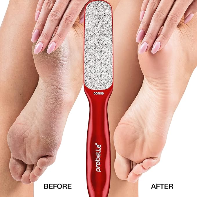 Probelle Double Sided Multidirectional Nickel Foot File Callus Remover - Immediately Reduces calluses and Corns to Powder for Instant Results, Safe Tool (Red)