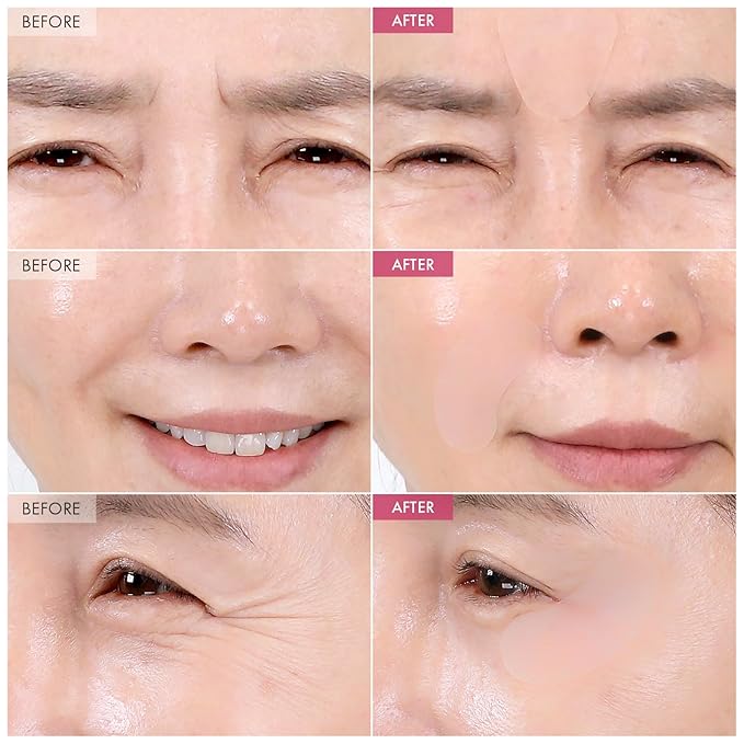 Anti-Wrinkle Patch with Hydrolyzed Collagen, Forehead & Eye & Smile Line Wrinkle Patches, Anti-Wrinkle Tape, K-Beauty Overnight Under Eye Patches, Korean Skincare, 5ea (10patches X 5)
