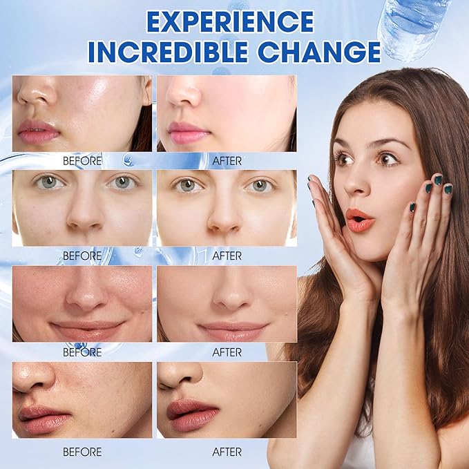 Hyaluronic Acid Powder, Hyaluronic Acid Powder for Skin Care, Low Molecular Weight, Vegan Cosmetic Grade, Water-Soluble Moisturizing Ingredient for DIY Facial Serum & Anti-Aging Skincare