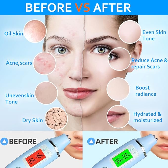 Jelly Mask for Facials Professional,Hydrating Deep Cleaning Face Mask Powder Set,(Hyalorunic Acid, Rose,24K Gold,VC Essence,Aloe Vera)