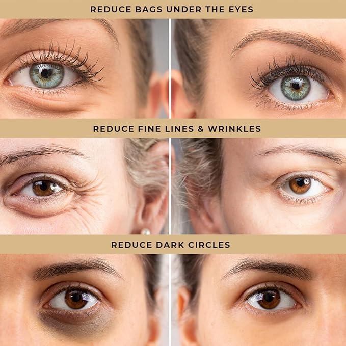 Instant Eye Bag Tightening Cream: Temporary Under Eye Puffiness Firming Removal - Rapid Tightener Reducer Treatment for Senior Men and Women, 0.5oz