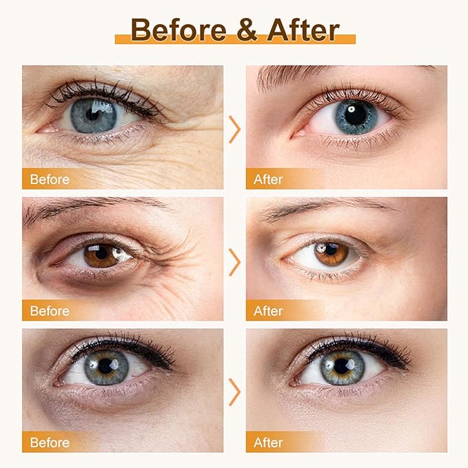 Retinol Under Eye Balm Stick, Anti-Aging Retinol Eye Stick for Dark Circles and Puffiness, Smooth Wrinkle Fine Lines, Firm Skin, Non Greasy, Hydrating and Nourish on the Skin Around the Eyes