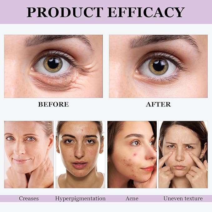 Venature Bakuchiol Retinol Rejuvenation Serum, Retinol & Vitamin for Wrinkles Bakuchiol Retinol Face Serum Korean, Retinol Serum for Wrinkles (2Pcs)