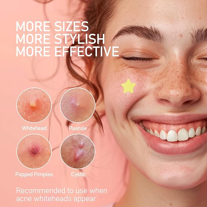 Pimple Patches for Face, 4 Shapes 200 Counts Acne Patches, Cute Star Hydrocolloid Patches Zit Patches, Blemish Patches with Salicylic Acid, Blemish Patches Tea Tree Oil
