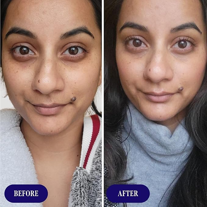 Three Ships Dream Shorea Butter Rejuvenating Night Cream with Bio-Retinol - Intensely Hydrates to Reveal Brighter, Smoother, Even Toned Skin (50g)