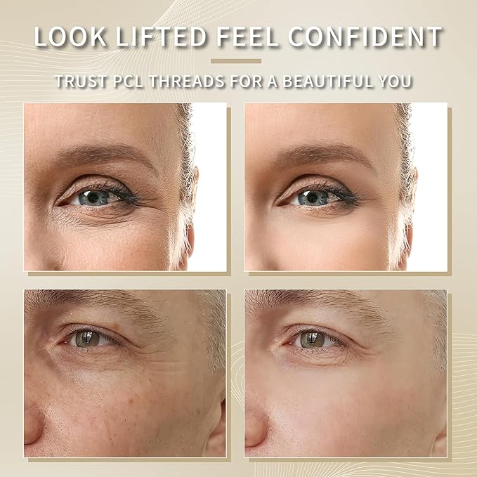 elves PCL Threads for Face Lift Mono Threads 30G13mm Pcl Smooth Threads Sharp Tip PCL Threads Mono 20Pcs Long-Lasting Skin Tightening Smoothing of Wrinkles