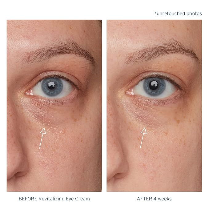 Santo Remedio, Piel Eterna, Revitalizing Eye Cream, Illuminating Eye Cream, Helps Reduce Dark Circles, Contains Marina Algae, Caffeine, Aloe, Hyaluronic Acid, Vitamin E, For All Skin Types, 1 Fl. Oz.