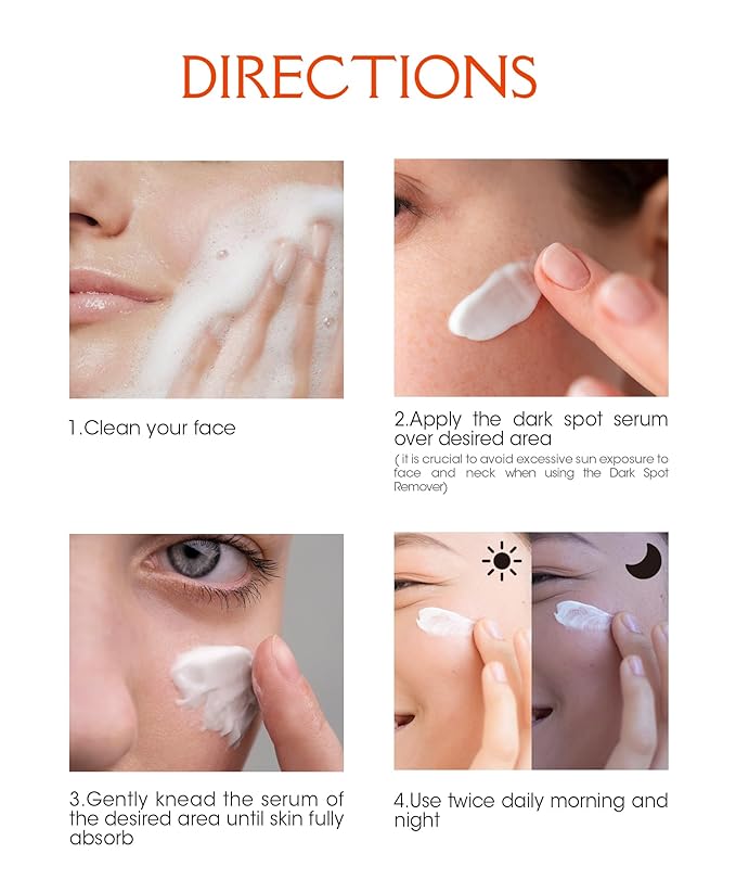 Dark Spot Remover for Face and Body, Dark Spot Corrector Glow Serum, Skin Brown Spot Remover, Skin Care Face Cream, Sun Spot Remover, Age Spot Corrector, Rapid Tone Repair 1oz