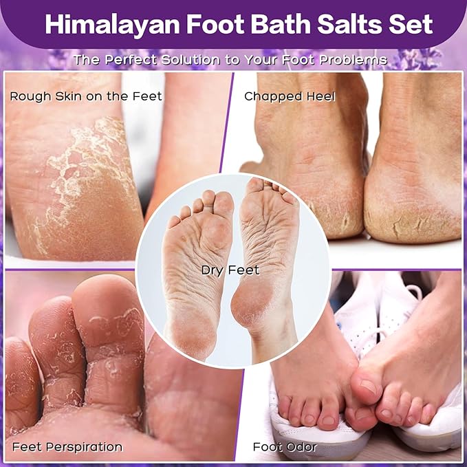 Himalayan Pink Foot Soak Salt Tea Tree Oil Foot Soak Kit, Lavender For Toenail Repair, Athletes Foot, Softens Calluses, Soothes Sore & Tired Fee