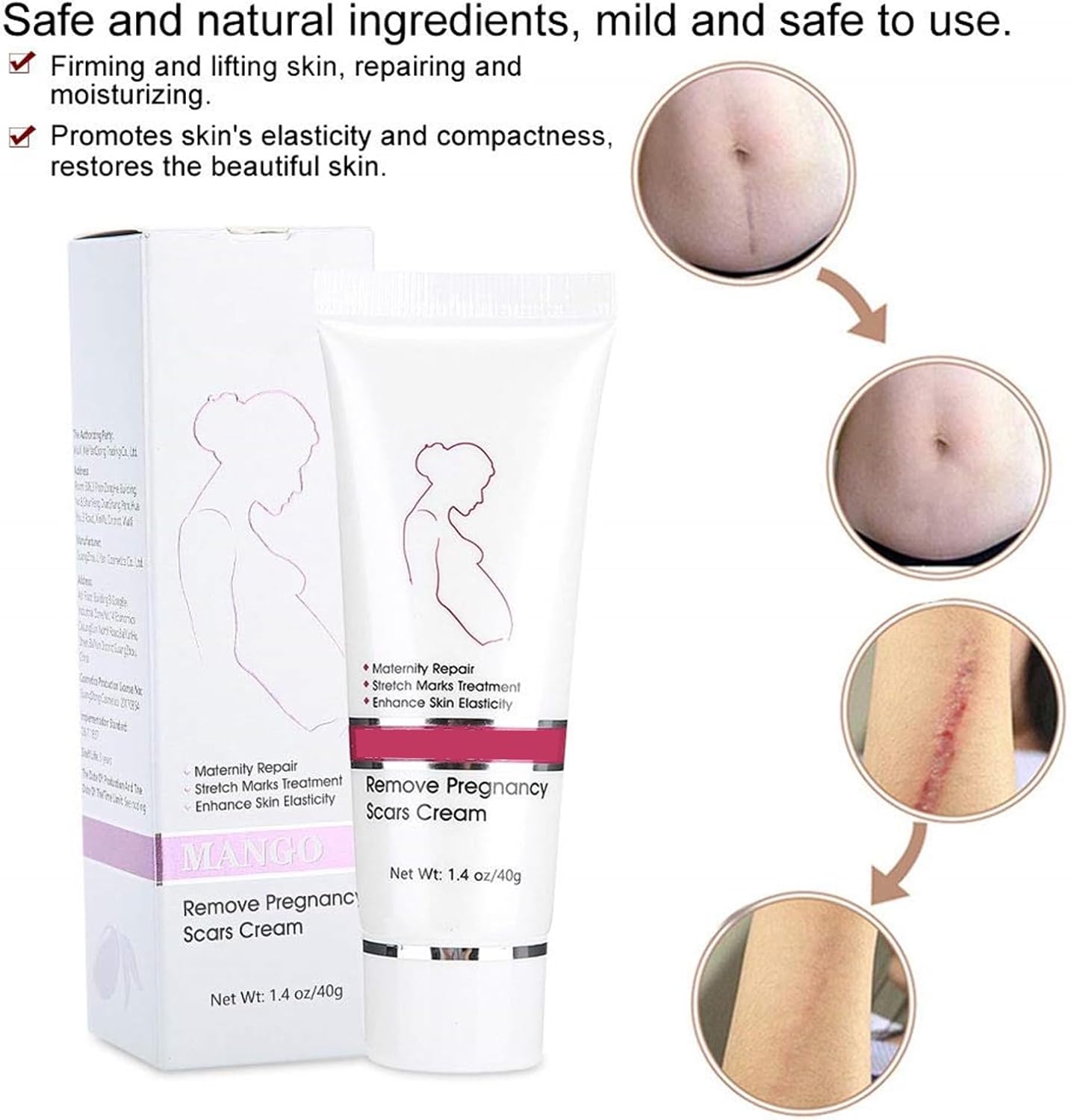 RtopR Stretch Marks and Scar Cream,Crema para Estrias De Embarazo,Stretch Marks Postpartum Repairing Cream Wrinkles Diluting Removal Cream Crema De Cacao para Cicatrices