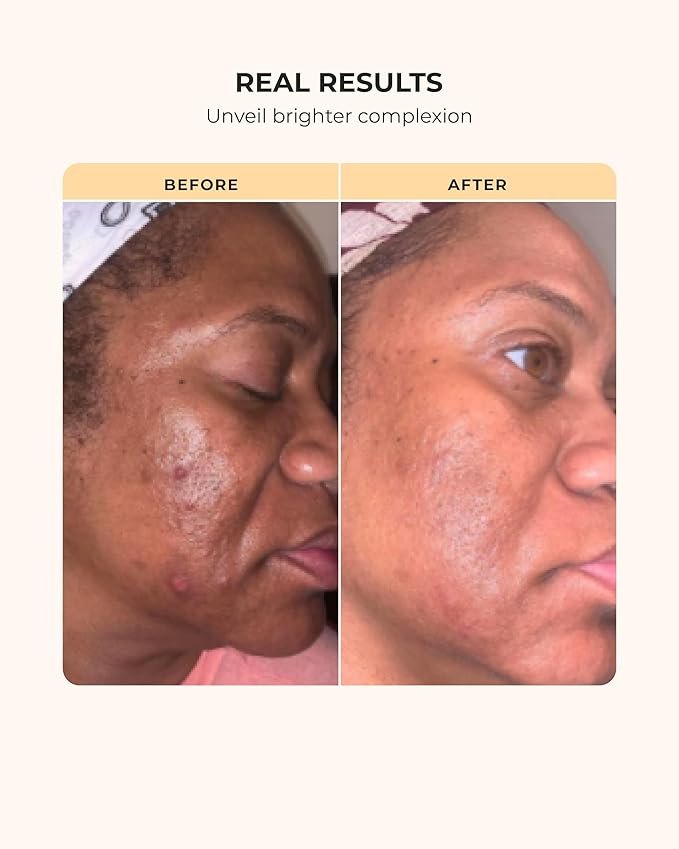 Buttah Skin Transforming Kit for Melanin Rich Skin | CocoShea Revitalizing Cream 2 oz | Vitamin C Serum 1 oz | Buttah Cleanser 3.4 oz | Black Owned Skincare