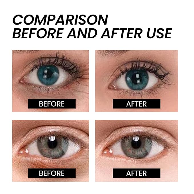 Anti-Aging Eye Cream - Instant Firming Treatment Reduces Under Eye Bags