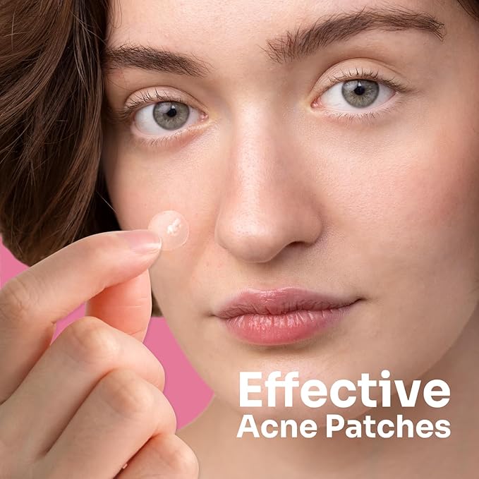 Conkote Hydrocolloid Acne Pimple Patches, 15mm Large Pimple Patches to Absorb Acne Secretions for Face and Skin, 45 Counts