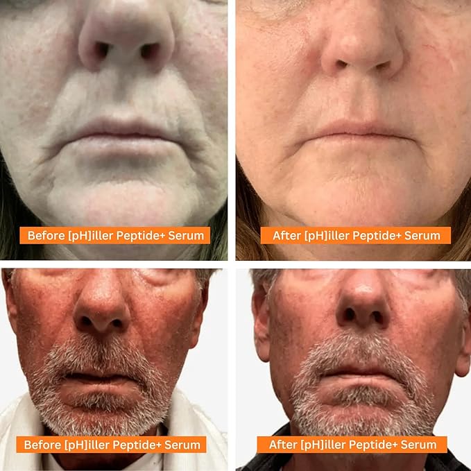 pHiller Peptide Serum - Advanced Anti Aging Face Tightening Serum for Fine Lines and Wrinkles, Hydrating Peptides Facial Formula for Skin, with Argireline + Tripeptides; Vegan (2-Pack)