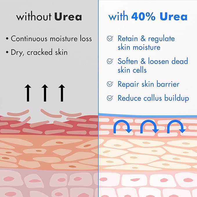 Ebanel Urea Cream 40% plus Salicylic Acid 2%, Foot Cream for Dry Cracked Heels Feet Knees Elbows Hands, Foot Dead Skin Cuticle Callus Remover Toenail Softener, Keratolytic Skin Barrier Repair, 6-Pack