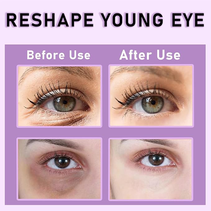 Collagen Eye Cream Anti Aging - Under Eye Cream for Dark Circles - Retinol Eye cream - Firming Eye Serum - for Puffiness and Bags Under Eyes - Smooth Eye Bags Treatment for Women