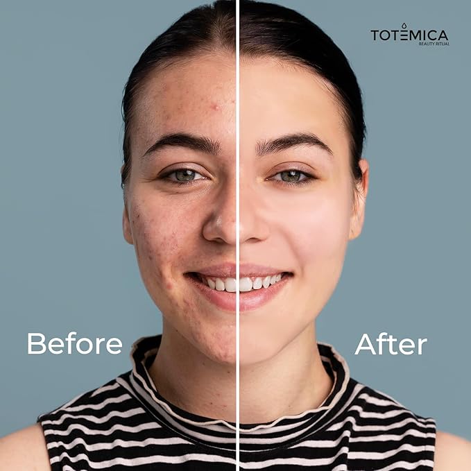 Face Moisturizer with Niacinamide, Hyaluronic Acid, and Peptides, Wrinkle Filler Anti Aging Serum, Firming Moisturizer for All Skin Types - Vegan, Cruelty-Free (1.69 Fl Oz)