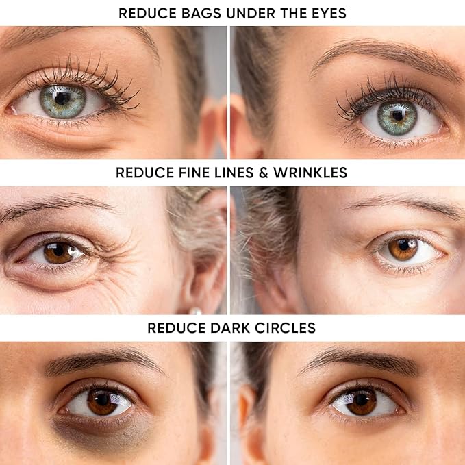 Instant Ageless Eye Cream – Anti Wrinkle Cream, Removes Under Eye Puffiness, Bags, Expression Lines, & Dark Circles. Powerfully Tighen & Lifts Sagging Skin. Disappears Before Your Eyes In Minutes.