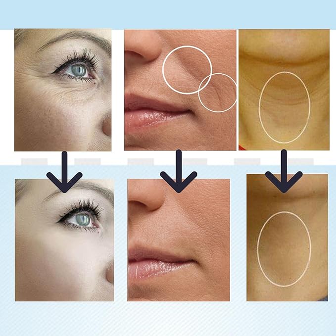 Facial and Neck Massager, Multi-Mode Adjustabl, Facial Shaping Tool, Can Be Used with Lotion to Improve Skin Condition (White)