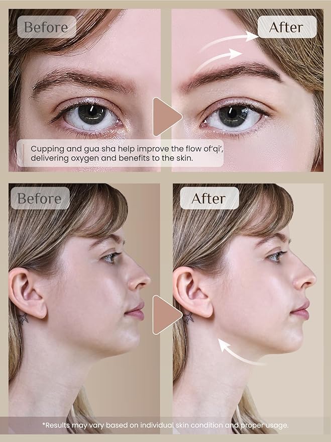 Rena Chris Facial Cupping Set & Gua Sha Facial Tool - Silicone Cupping Set & Rose Quartz Gua Sha Stone - Face Cupping Therapy Set for Natural Skin Care, Puffiness, Lip Plumping(Pink)