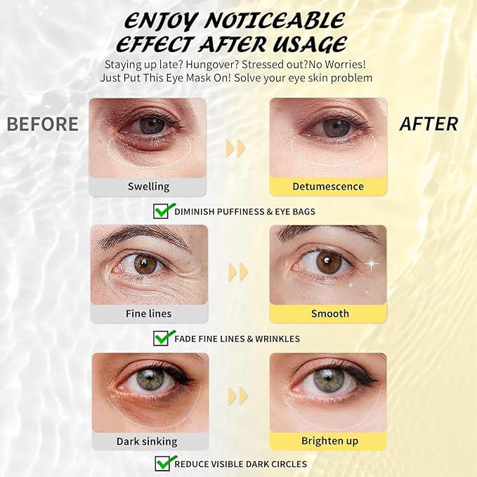 Under Eye Patches(50 Pairs), 24K Gold, Caffeine, Hyaluronic Acid, Aloe Vera Eye Masks for Dark Circles Puffy Eyes Undereye Bags, Eye Skin Care Gift Set for Bachelorette Party Favors