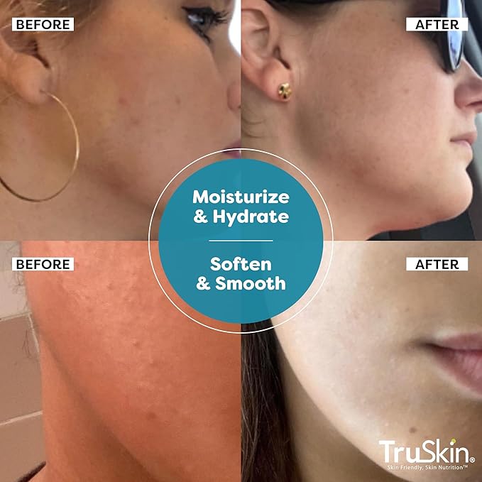 TruSkin Hyaluronic Acid Serum for Face + 7 Ultra Hydrating Ingredients – Best Face Serum for Moisturizing, Visibly Plumping Skin & Smoothing the Look of Fine Lines, 2 fl oz