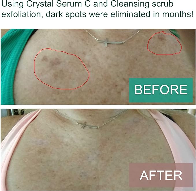 Carolyn's Facial Formulas Crystal Facial Serums C | Vitamin C Serum for Face | Skin Clearing Serum | Made in USA | Organic, Certified Vegan and Cruelty-Free. Unscented.(15 ml – 0.5 fl oz)