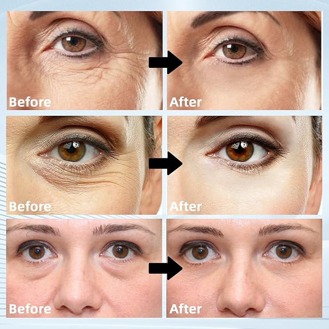 Under Eye Masks 60PCS – Retinol & Collagen Eye Patches for Dark Circles and Puffiness, Hydrating Cooling Under Eye Pads for Women & Men, Skin-Firming Gel Patches for All Skin Types (1PC)