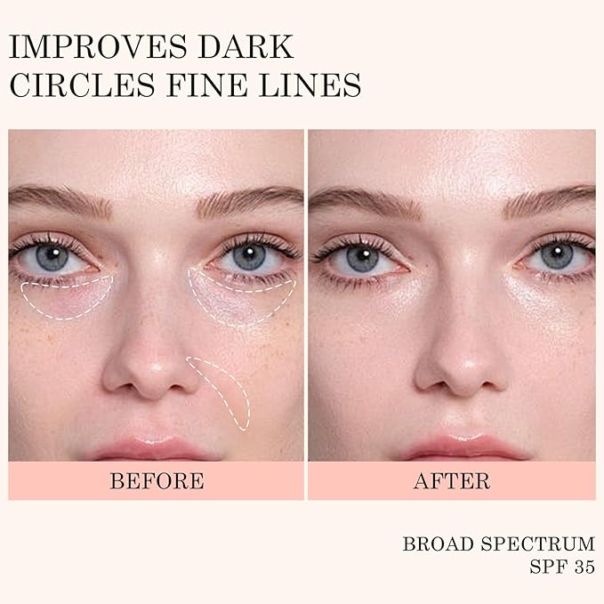 KYDA Mineral Sunscreen Eye Cream, 3-in-1 Anti-Aging Eye Cream, SPF 35, for Dark Circle and Fine Lines, Pink