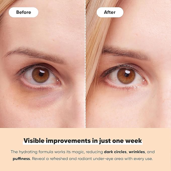 LE GUSHE K-BEAUTY Pimple Patches for Face (132 dots) & Under Eye Patches (30 Pairs). Gold Eye Mask with Collagen & Amino Acid, Cooling Eye Care for Wrinkles, Puffy Eyes & Dark Circles