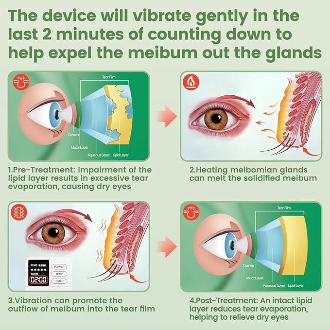 Aroma Season Vibrating Heated Eye Mask for Dry Eyes, 3000mAh Cordless Warm Eye Compress for Stye, Blepharitis, Rechargeable Electric Eye Heating Pad for MGD, Included Hygienic Eyelid Sheets