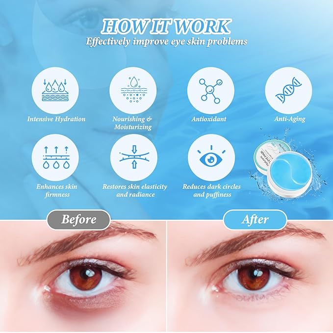 PITHER Under Eye Patches for Dark Circles, Eye Masks for Puffy Eyes Wrinkles Under Eye Bags Firmness 30 Pairs Skin Treatment Pads with Hyaluronic Acid and Collagen Women Men (Blue)