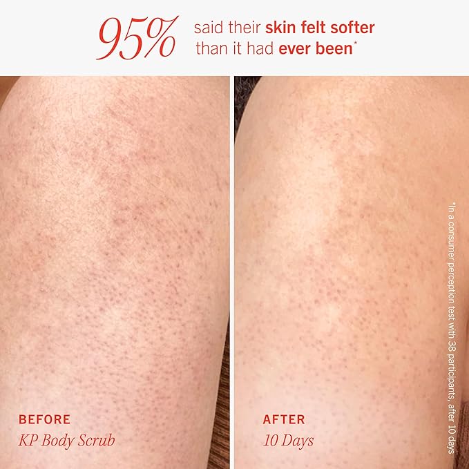 First Aid Beauty Soft + Smooth Starter Body Kit: KP Bump Eraser Body Scrub, 4 oz, Smoothing + Brightening Lotion (Peach), 1oz, & Ingrown Hair Pads, 28 Pads, Exfoliation & Hydrating Skin Care Set, 3ct