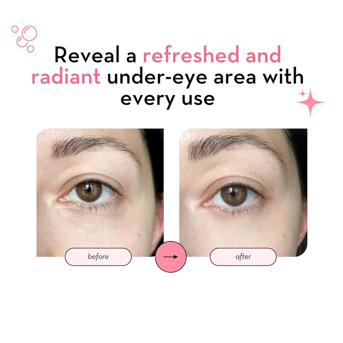 Elizabeth Mott Under Eye Patches with 24K Gold, Collagen, Niacinamide & Peptides - Hydrating & Brightening Eye Mask for Puffy Eyes and Wrinkles - Gifts for Women, Cruelty Free