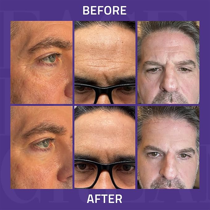 YEOUTH Instant Face Lift Cream, Temporary Skin Tightening Under Eye Cream for Women, Tightening and Lifting Concealer 15ml