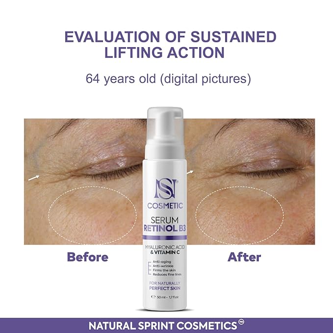 Anti-Aging Face Serum. Hyaluronic Acid, Vitamin C, Retinol, Vitamin B3 1,7 fl.oz (50ml) Firms the Skin and Reduces fine lines Wrinkles, deep and lasting hyper-hydratation