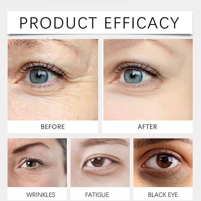 Dinkiss Lutein Eye Essence Oil, Vitamin C Lutein Eye Essence Oil, Improve Bags and Dark Circles, for Women Men (1, 1 pcs)