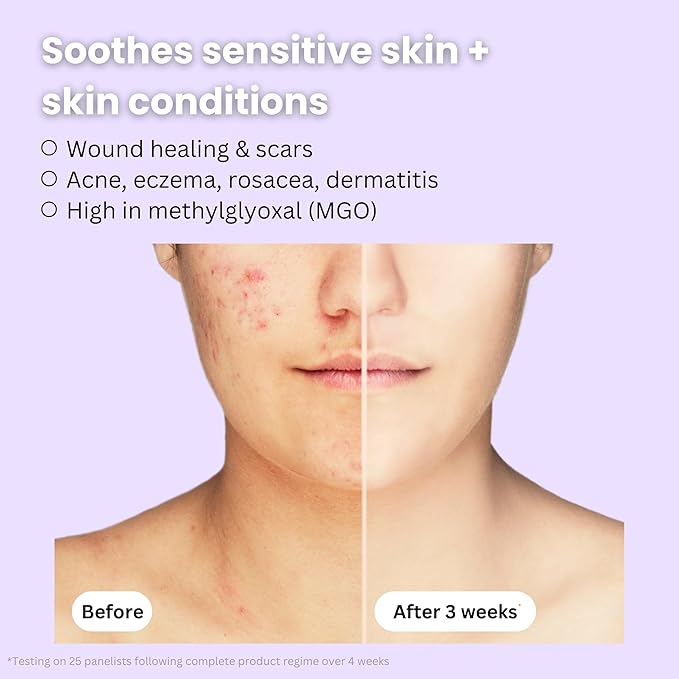 Organic Manuka Honey + Kanuka Oil Night Repair Face Moisturizer Cream | Rejuvenating, Calming, Restoring | 2.5 month supply, 2oz/60ml | Made in New Zealand