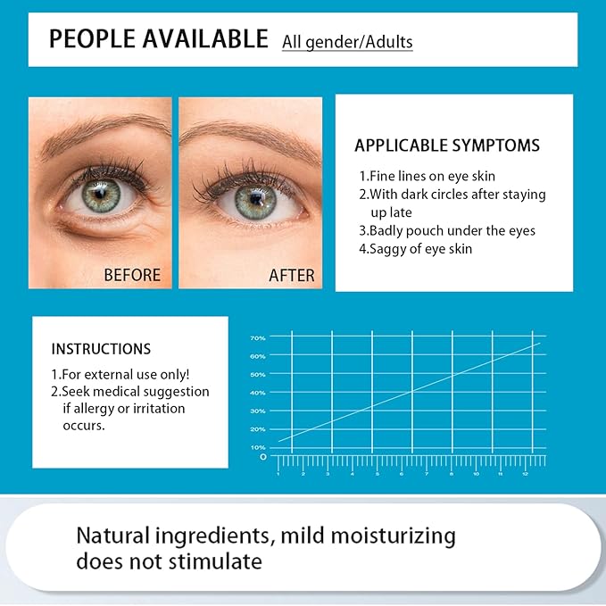 Under Eye Mask Patches, 30 Pairs Collagen Hydrating Moisturizing Smoothing Gel Pads for Puffy Eyes Bags,Dark Circles,Puffiness,Fine Lines,Wrinkles,Anti-Aging Sakura