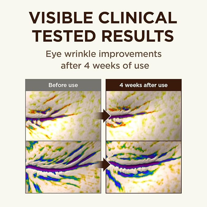 CKD Retinal 5X Guasha Eye Cream - Anti-Aging Eye Treatment for Wrinkles, Dark Circles & Puffiness, Hydrating & Firming, Korean Skincare for Radiant Eye Area, 1.01 fl oz