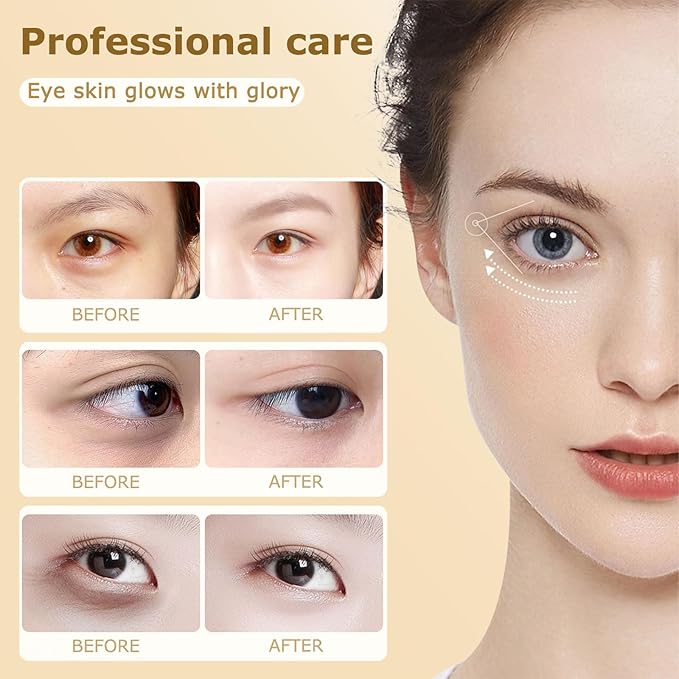 Dinkiss Lutein Eye Essence Oil - Lutein Eye Essence Oil, Lutein Eyes Vc Cream to Improve Eyes Bags Dark Circles (1pcs, 8ml/pcs)