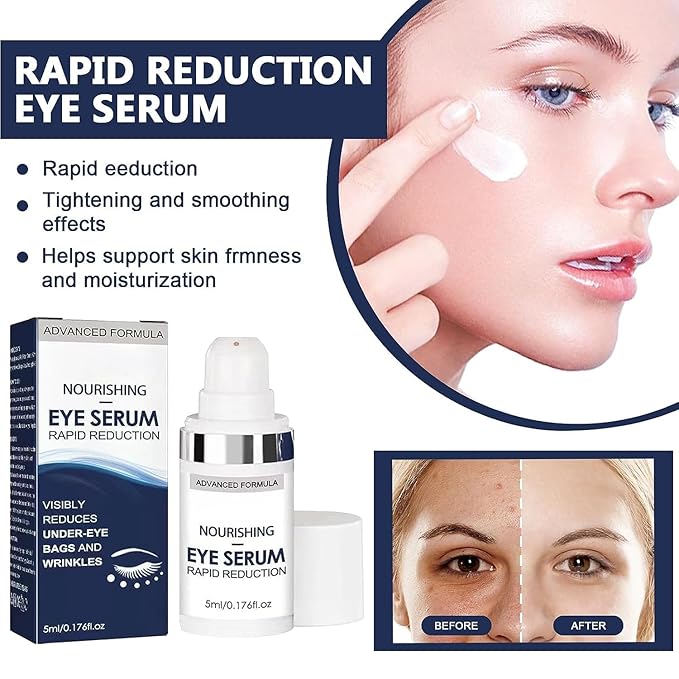 Rapid Reduction Eye Serum - Advanced Formula - Anti Aging Serum Visibly Reduces Under-Eye Bags-q2