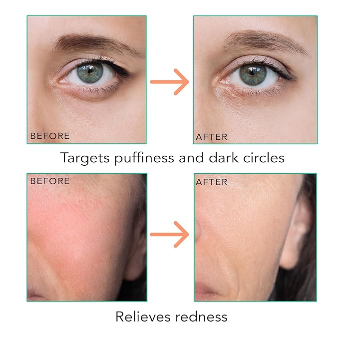 Beauty by Earth Ice & Rose Quartz Roller for Face - Face Massager Skin Care Tools with Small Eye Roller for Puffy Eyes