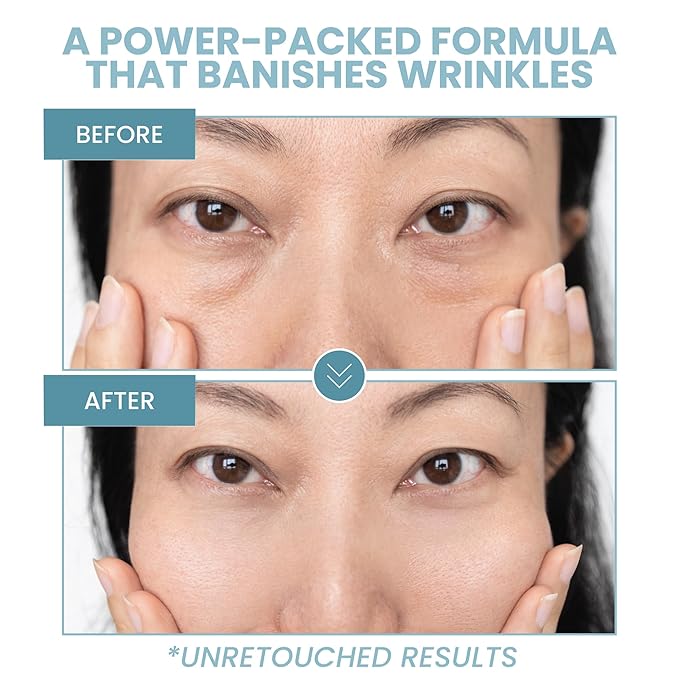 Eva Naturals Anti-Aging Eye Gel - Luxurious Hydrating Under Eye Cream For Dark Circles and Puffiness, Bags, Crows Feet, Wrinkles - With Hyaluronic Acid & Skin-Firming Peptides Eye Serum 2 oz (2 Pack)