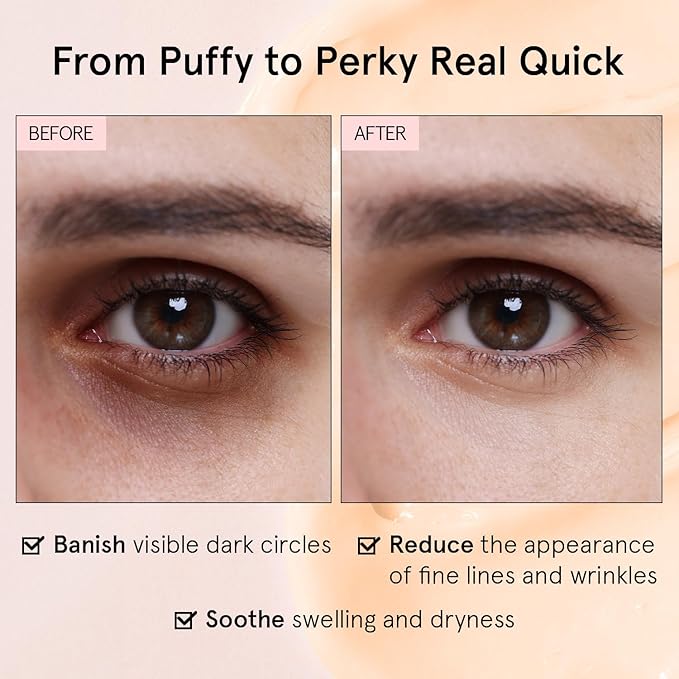 grace & stella Under Eye Cream for Dark Circles - Caffeine Eye Cream Anti Aging for Wrinkles - For Undereye Brightening, Puffiness, Wrinkles and Bags - Made in USA, Vegan (0.46 oz/13 g)