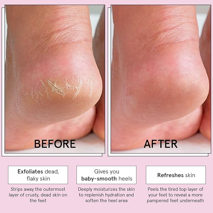 grace & stella Award-Winning Foot Peel Mask - Foot Peeling Mask with Aloe Vera - Moisturizing Foot Mask for Dry Cracked Feet - Foot Exfoliator for Baby Soft Feet (2 Pairs, Lavender)