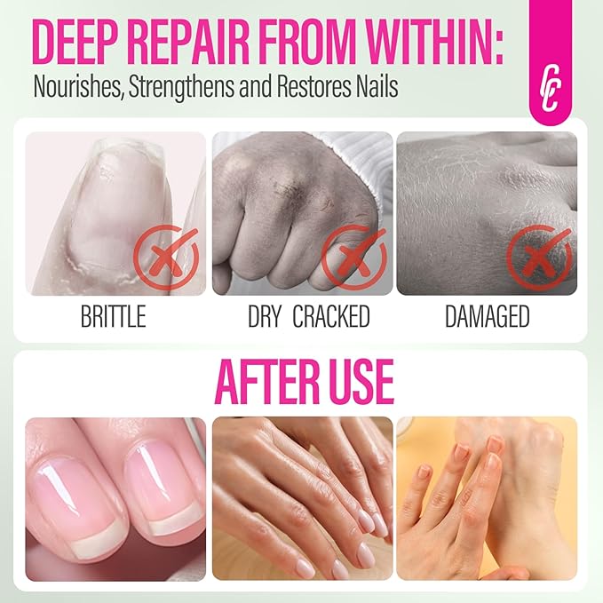 CHUCHU Nail Strengthener and Growth Serum: Natural Plant Repair Serum with Aloe Vera Scent - Nail Cuticle Care for Women Men Home Salon Gift