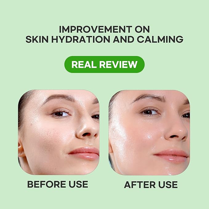 Epielle Cucumber Hydrating Serum Sheet Masks (5pk) | Korean Skincare | Facial Sheet Mask | Kbeauty, Mother's Day Gifts